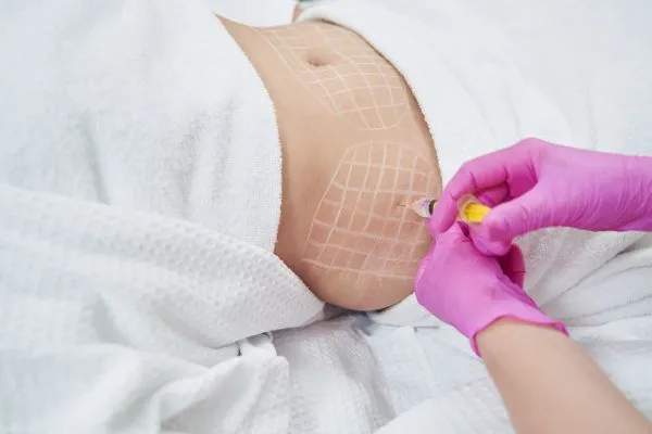 image of fat dissolving injections on love handles to help combat weight gain Malvern Wells