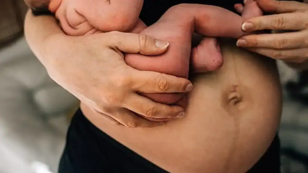 Why Is My Stomach Still Big After Pregnancy Malvern Wells?